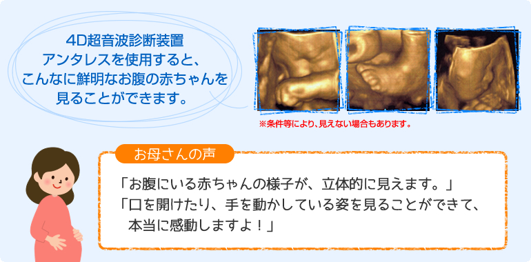 アンタレス